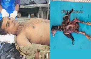 Ambikapur Latest News